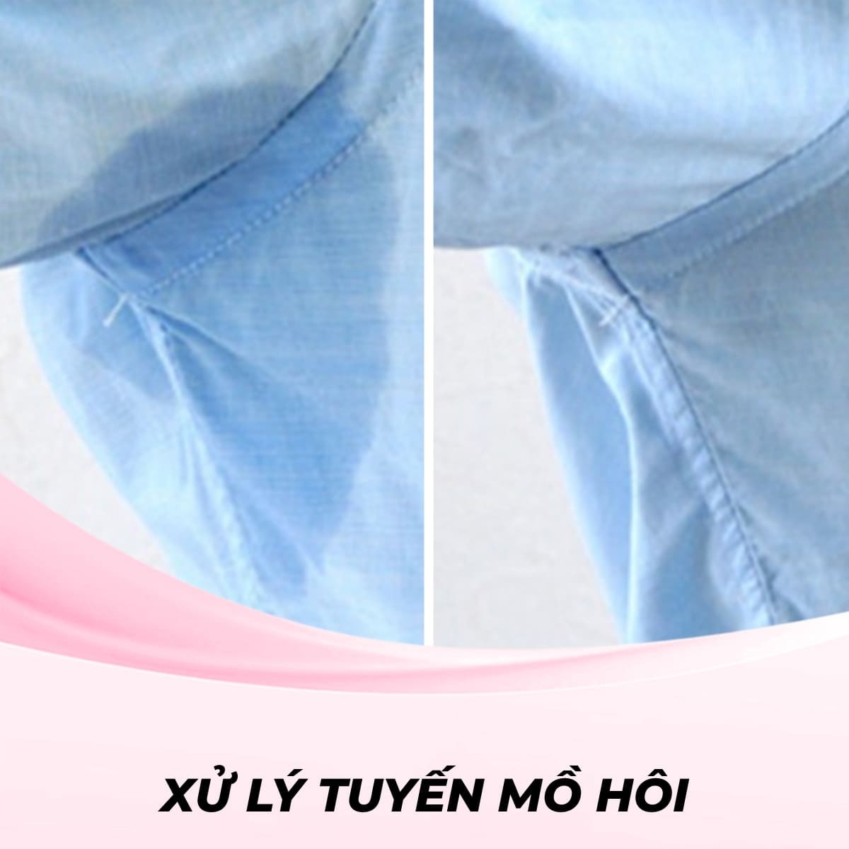 Xử lý tuyến mồ hôi nách bằng Công nghệ MiraDry