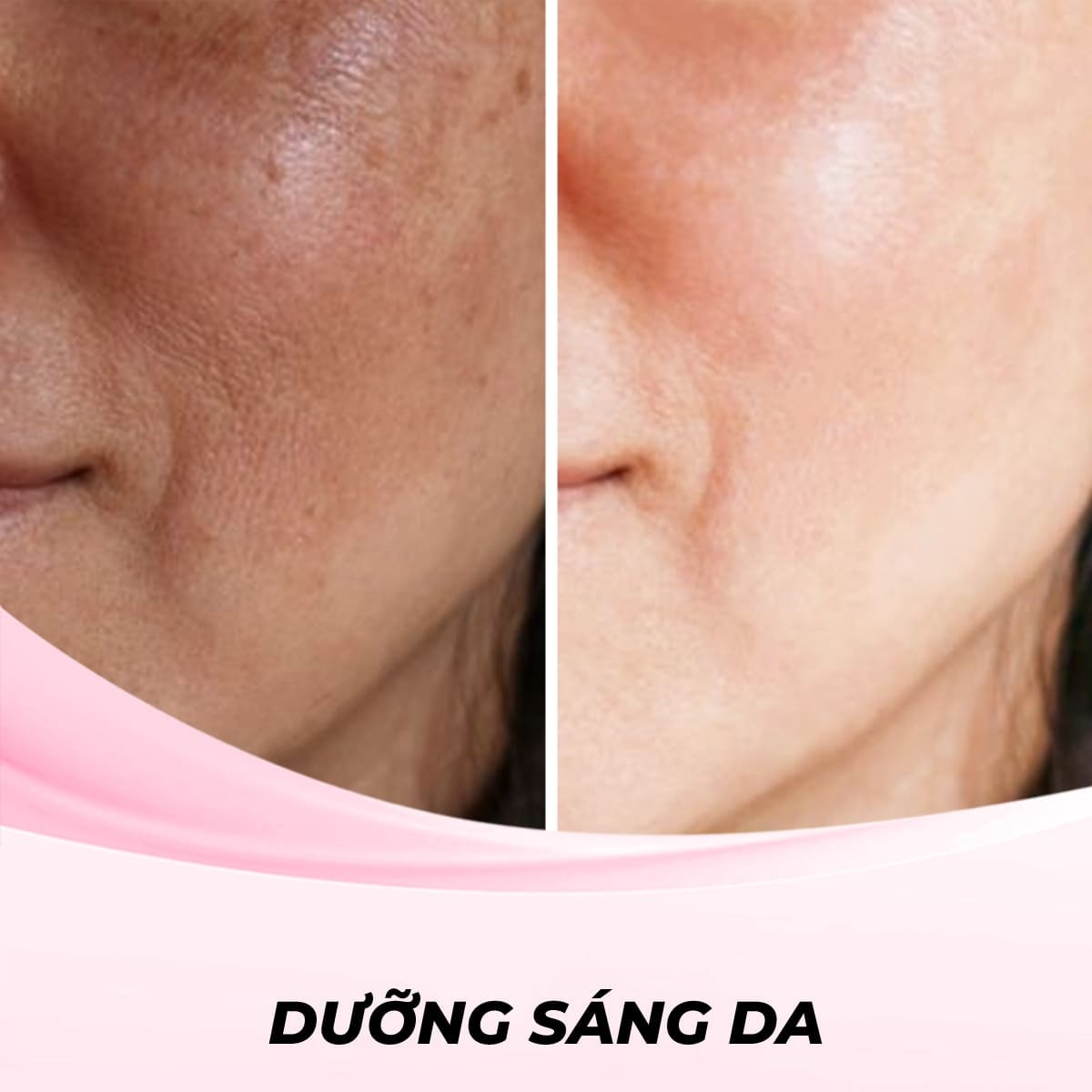 Dịch Vụ Điện Di Dưỡng Chất (Electroporation)