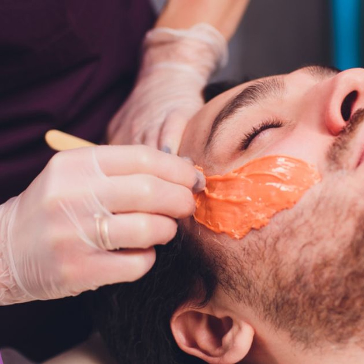 Triệt Lông Mặt Cho Nam Bằng Phương Pháp  Waxing