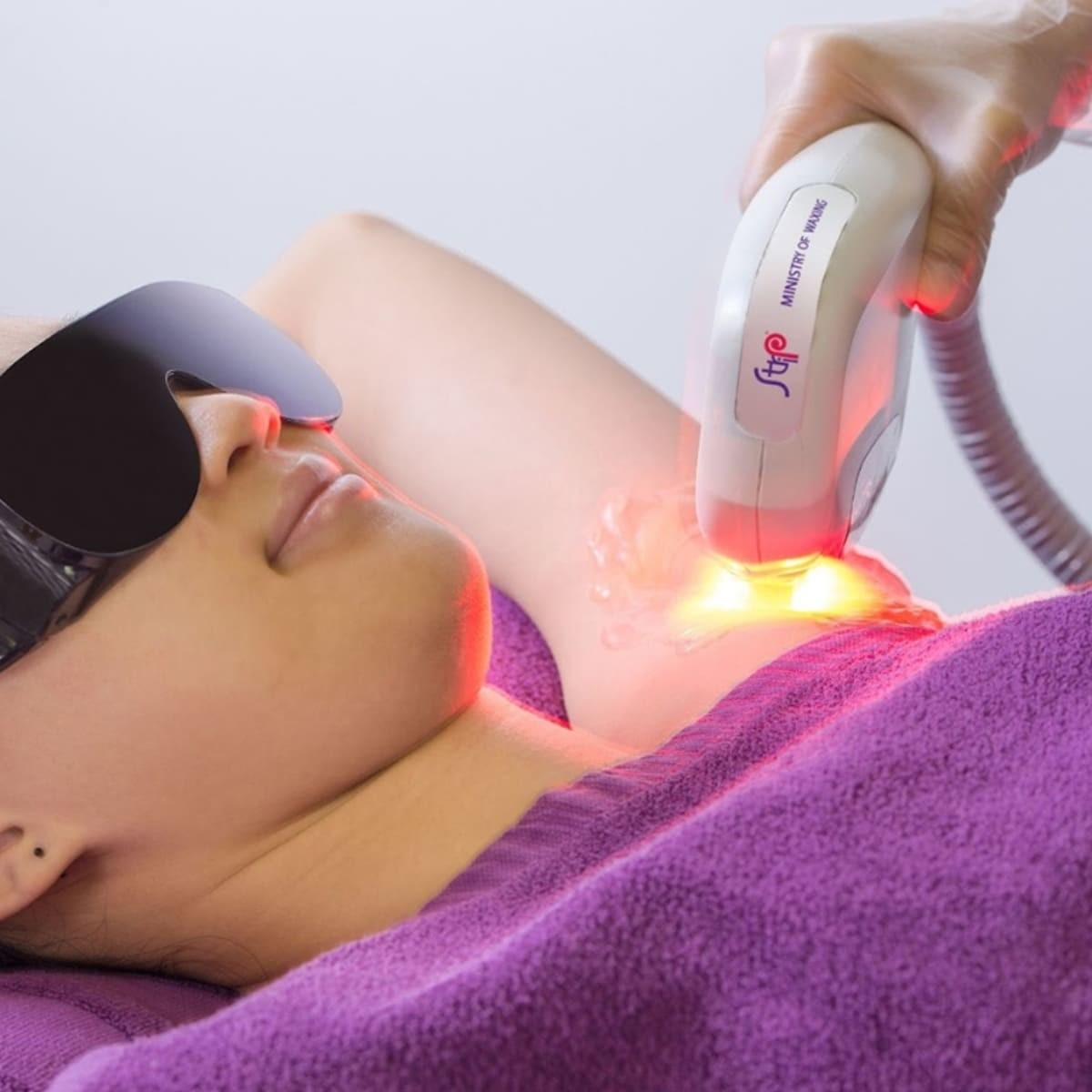 Triệt lông nách bằng công nghệ RF (Radio Frequency) - trải nghiệm