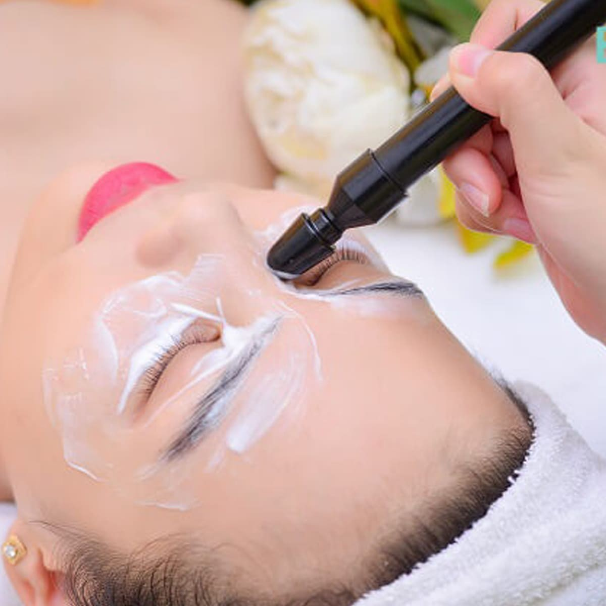 Triệt lông lưng bằng công nghệ RF (Radio Frequency)