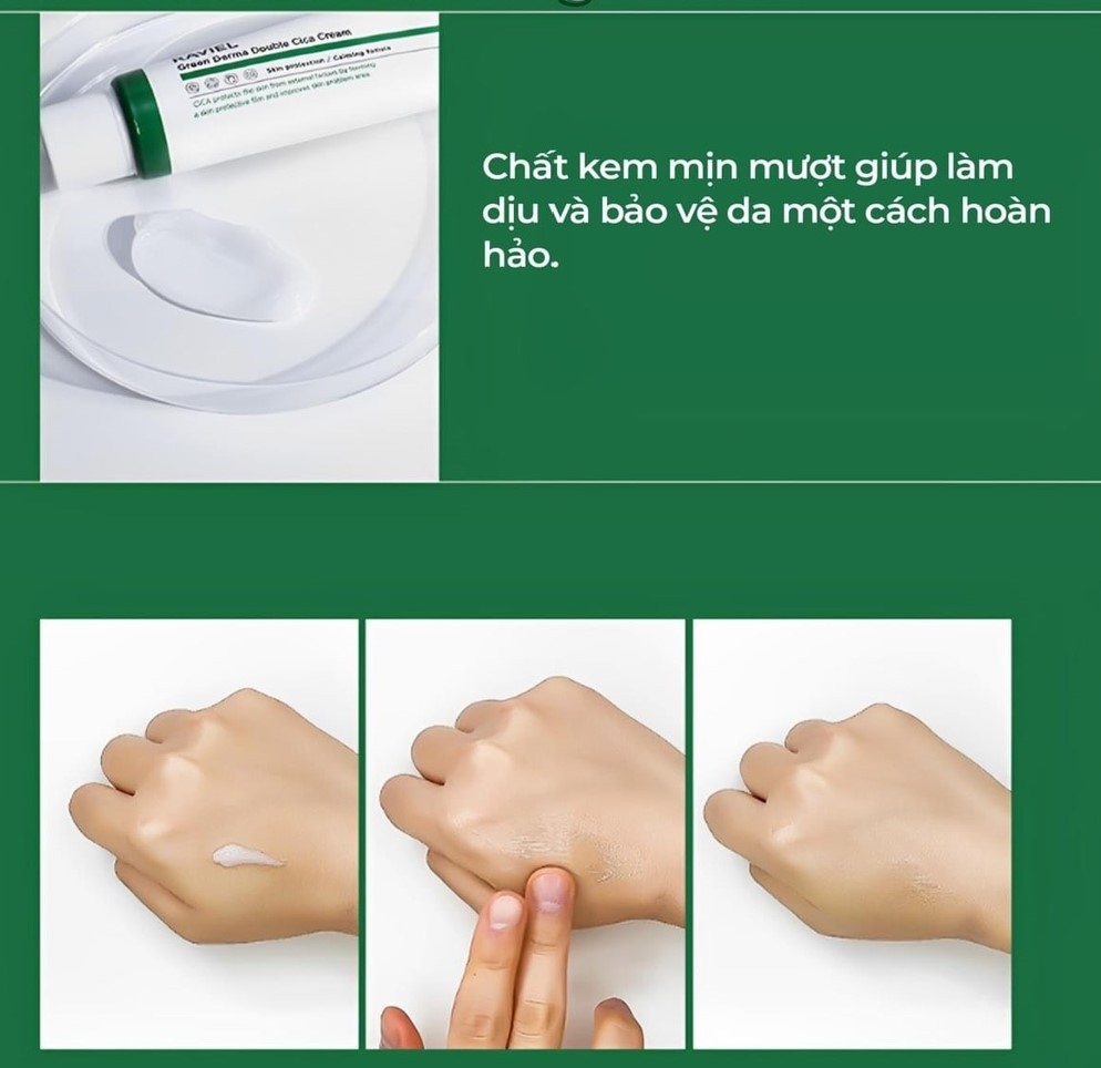 Kem làm dịu và phục hồi da mụn, da kích ứng Raviel Green Derma Double Cica Cream 50ml