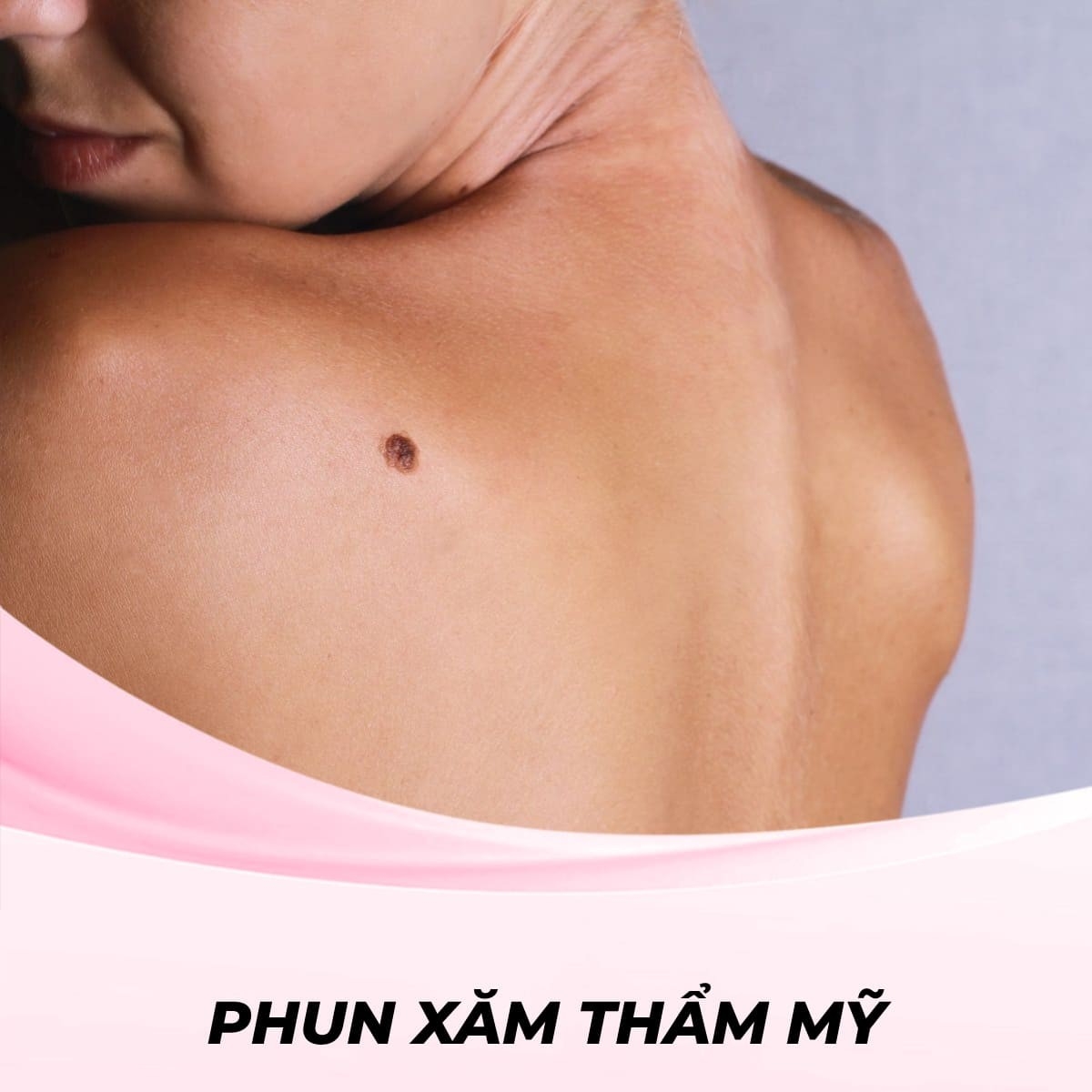 Tạo nốt ruồi phong thủy ở lưng