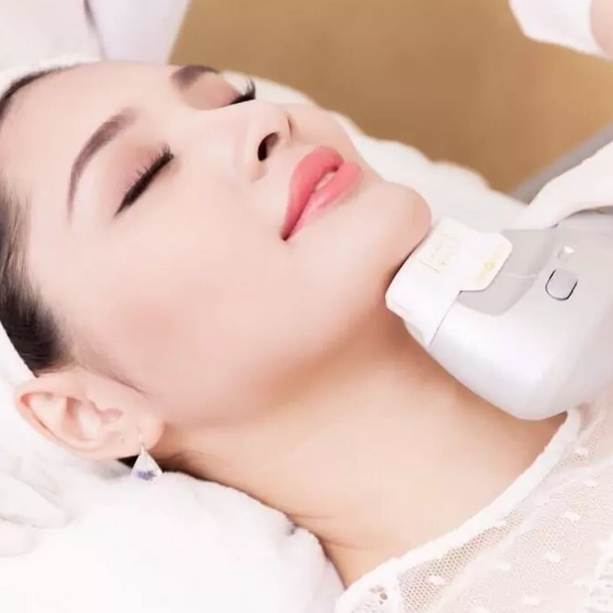 Trẻ Hóa Da Bằng Công nghệ HIFU - Trải Nghiệm 1 Buổi