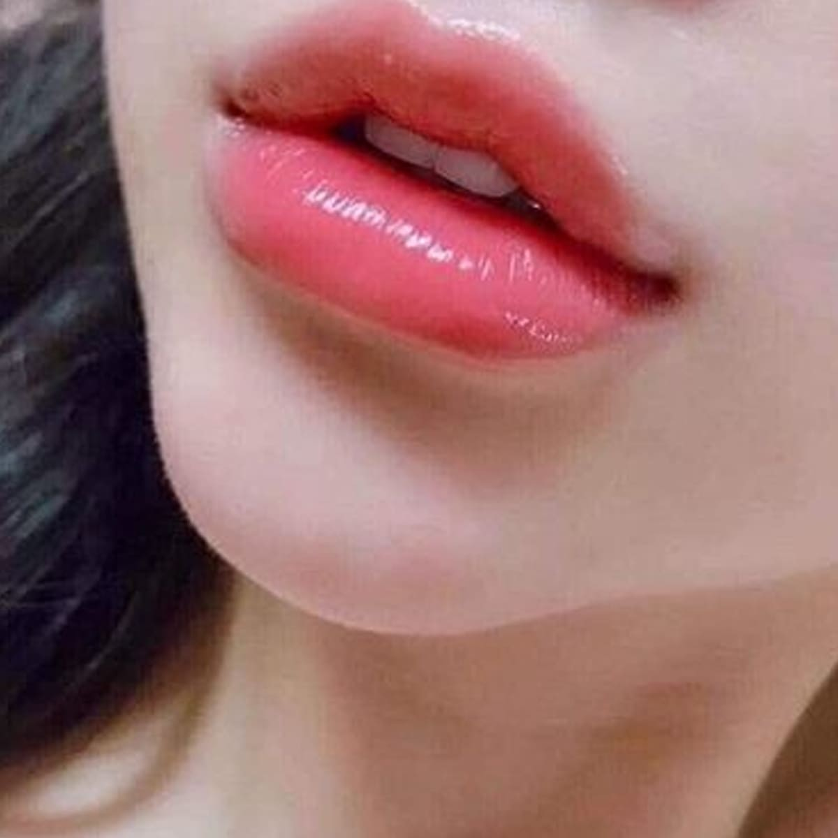 Tặng 1 dịch vụ khi sử dụng dịch vụ làm đầy môi bằng filler