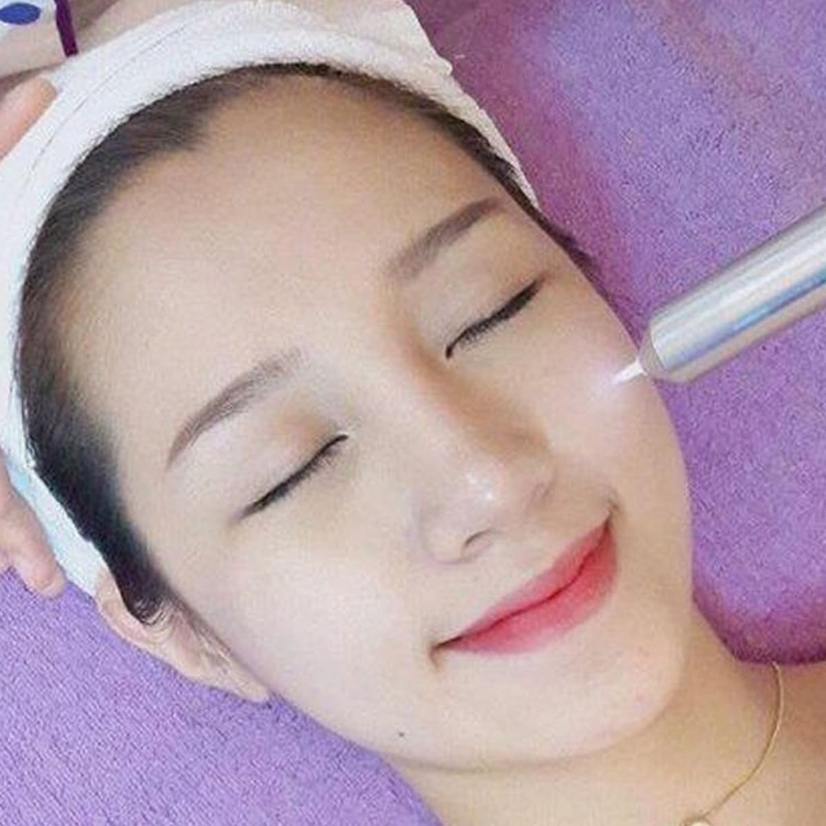 Xử lý mụn bằng công nghệ Plasma