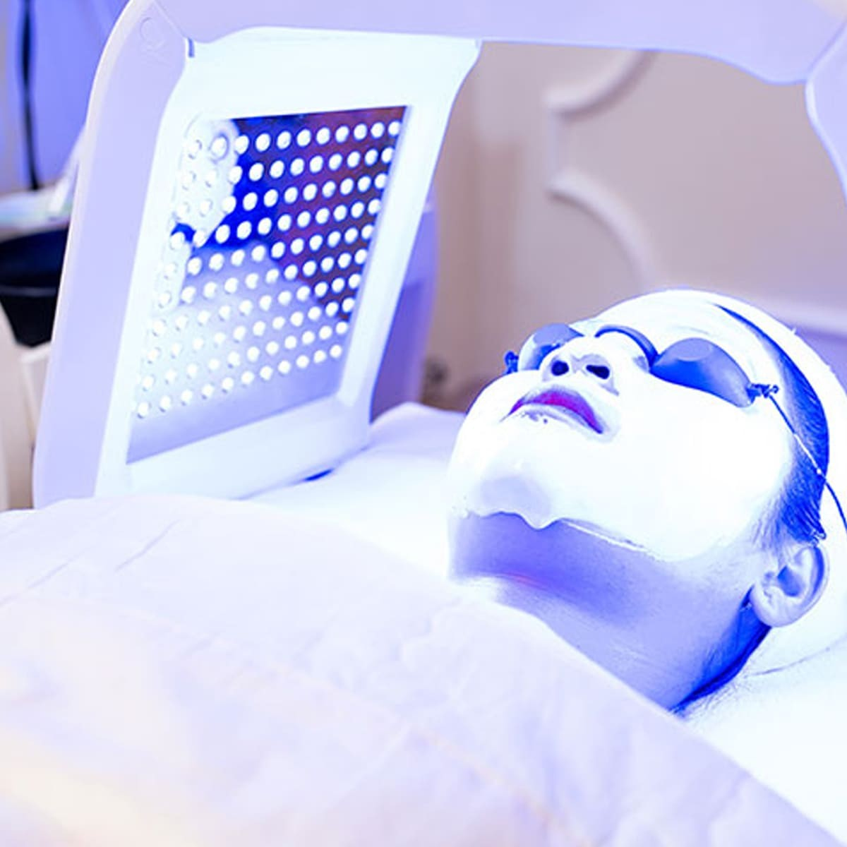Dịch vụ Xử Lý Mụn bằng Ánh sáng xanh (Blue Light Therapy)