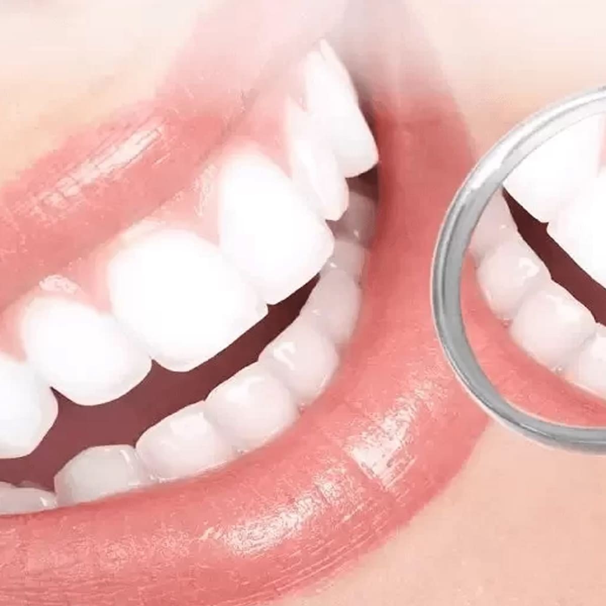 Lắp Đặt Răng Sứ Sage Shine