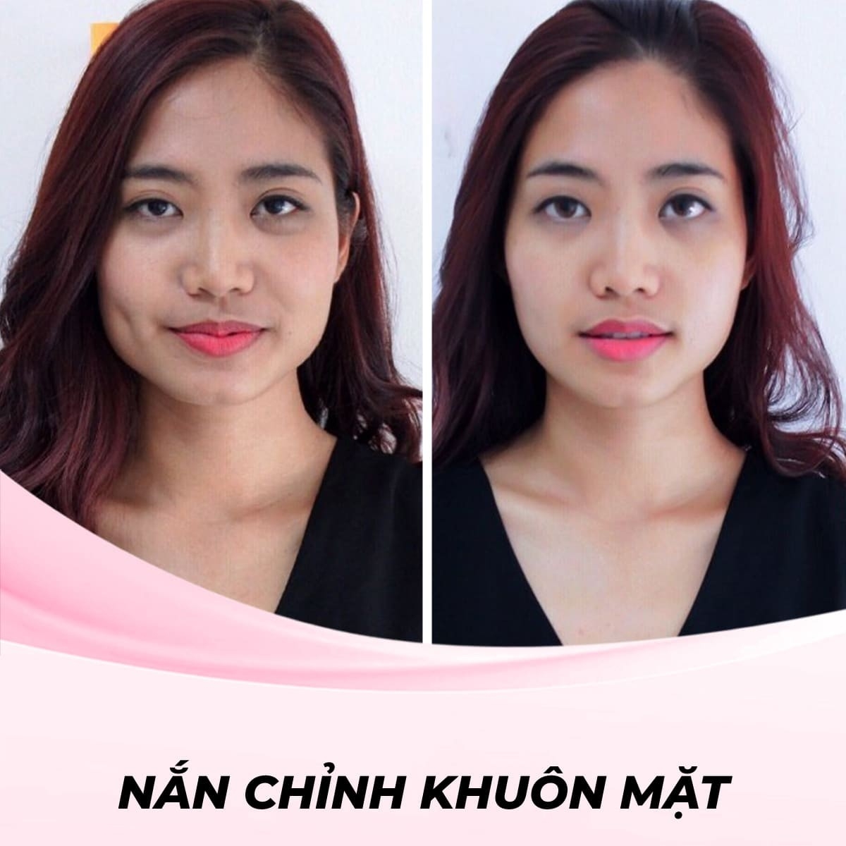 Kỹ Thuật Massage Gua Sha nắn chỉnh khuôn mặt