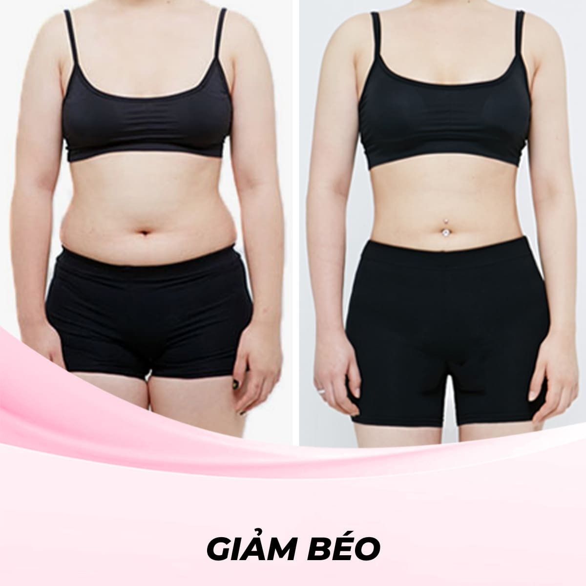 Giảm Béo Bụng Bằng Công Nghệ RF (Radio Frequency)