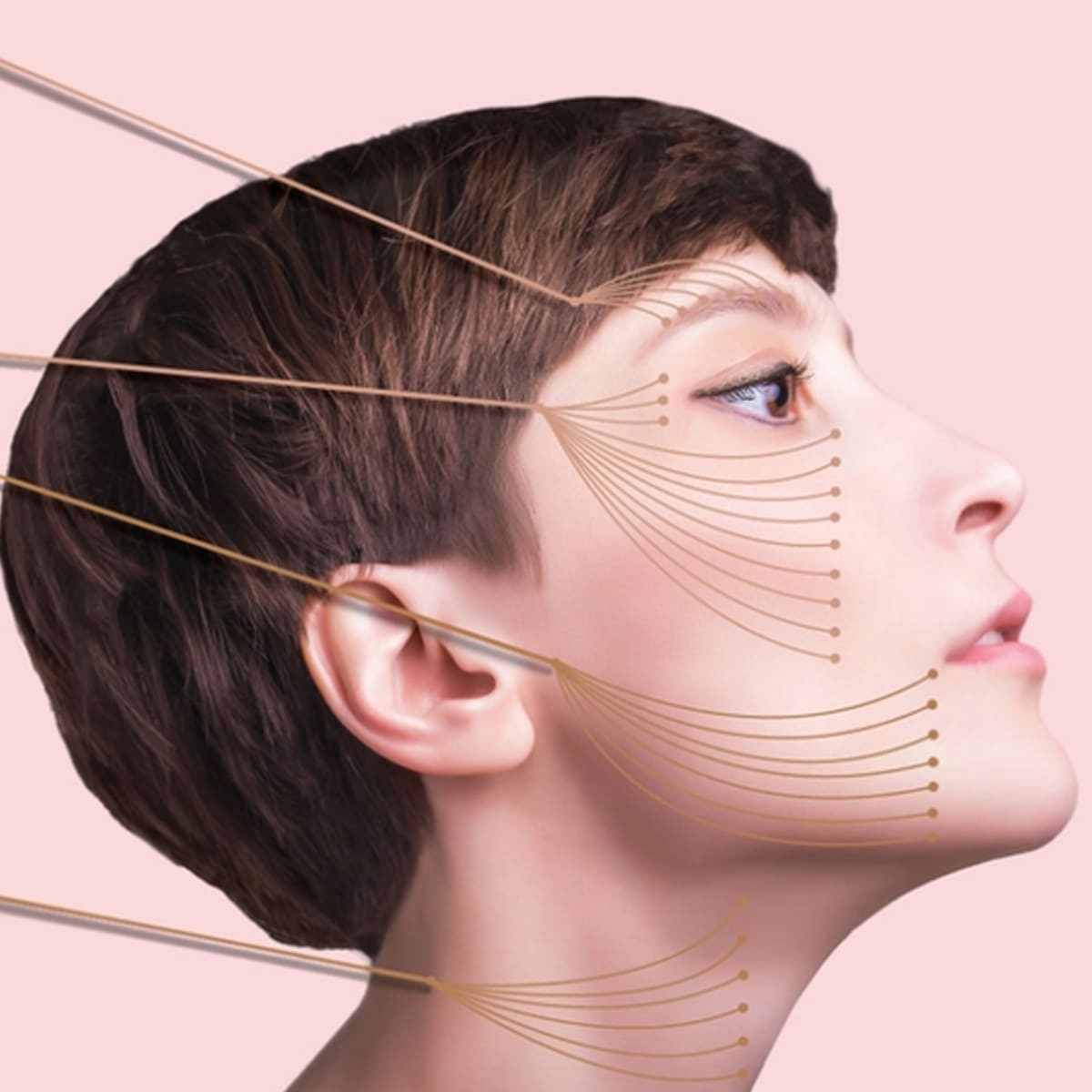 Dịch vụ nắn chỉnh khuôn mặt bằng phương pháp căng chỉ (Thread Lift)