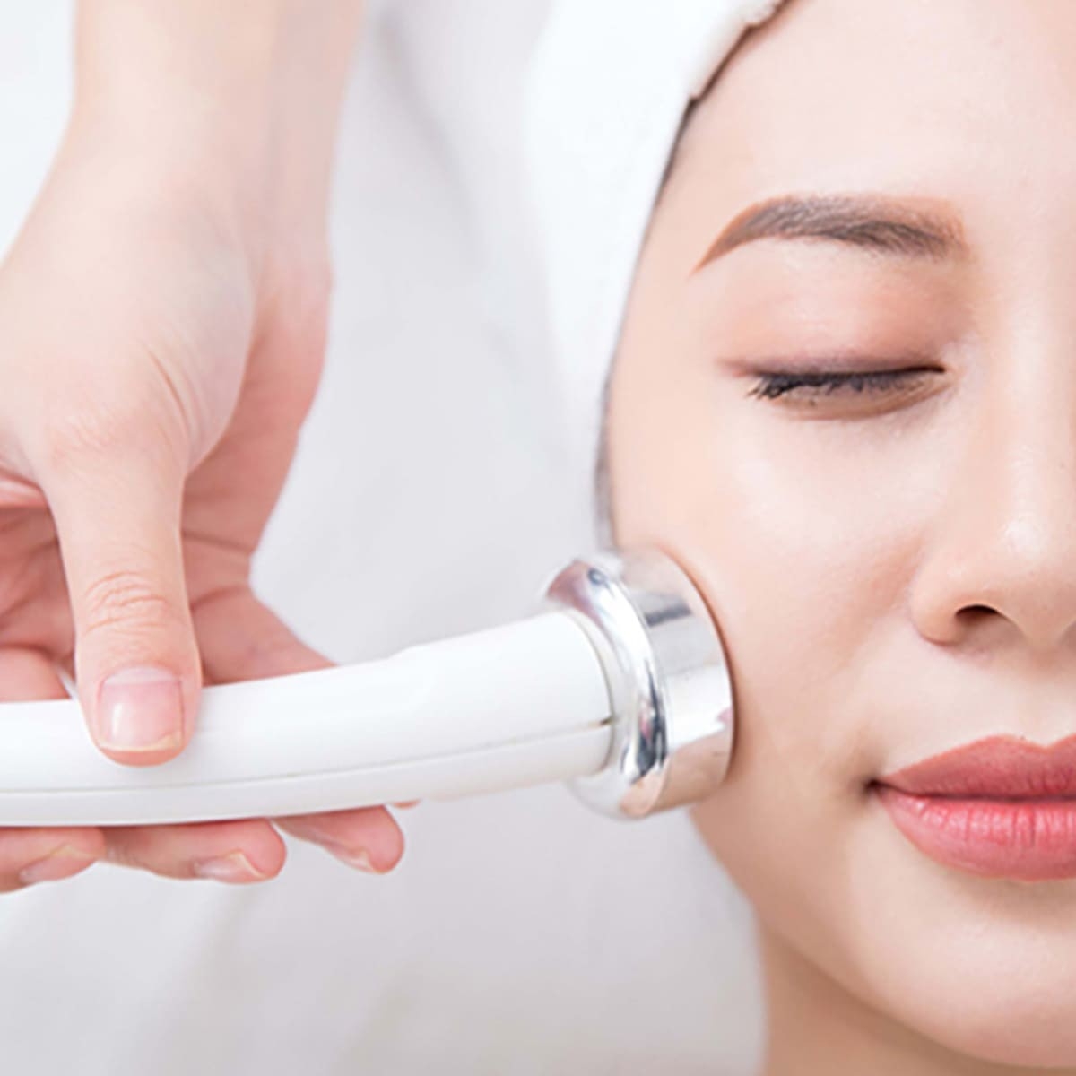 Xử Lý Bớt Sắc Tố Da Bằng Công Nghệ RF (Radiofrequency)