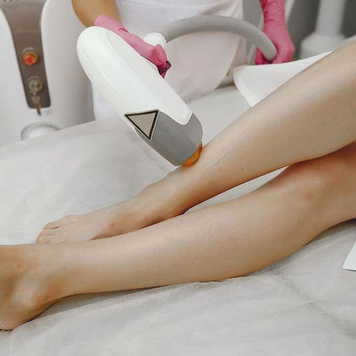 Triệt lông chân bằng công nghệ Laser Alexandrite