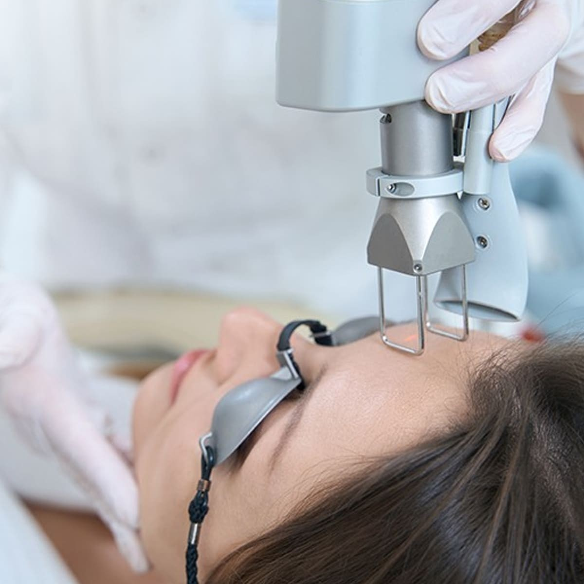 Trẻ Hóa Da Bằng Laser Fractional Co2