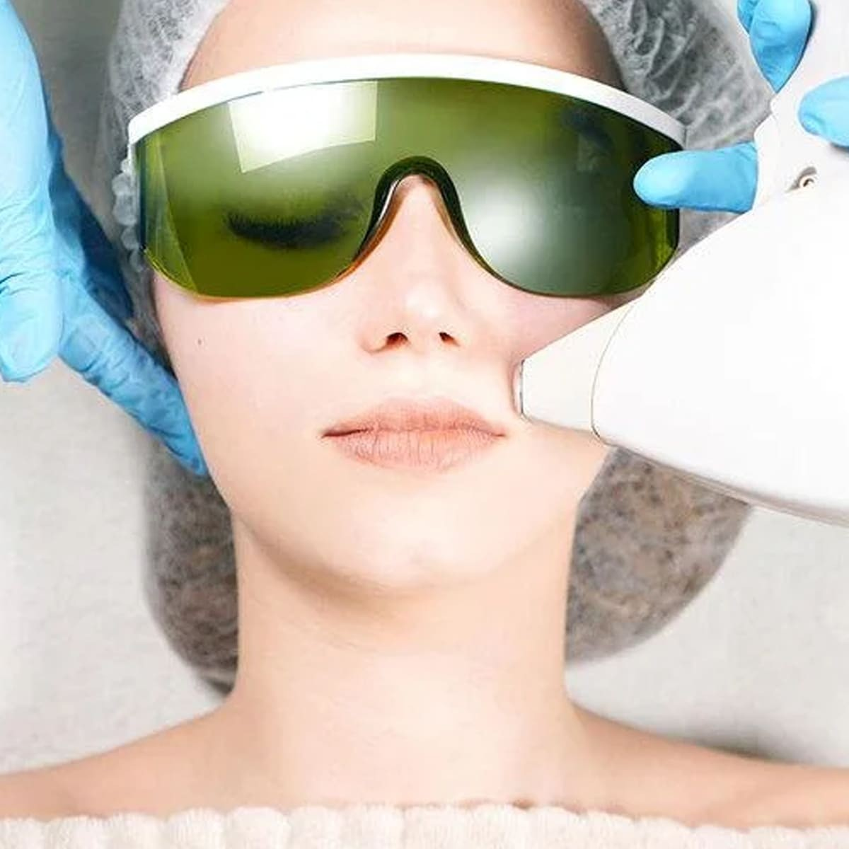 Triệt Lông Mép Bằng Phương Pháp Điện Di