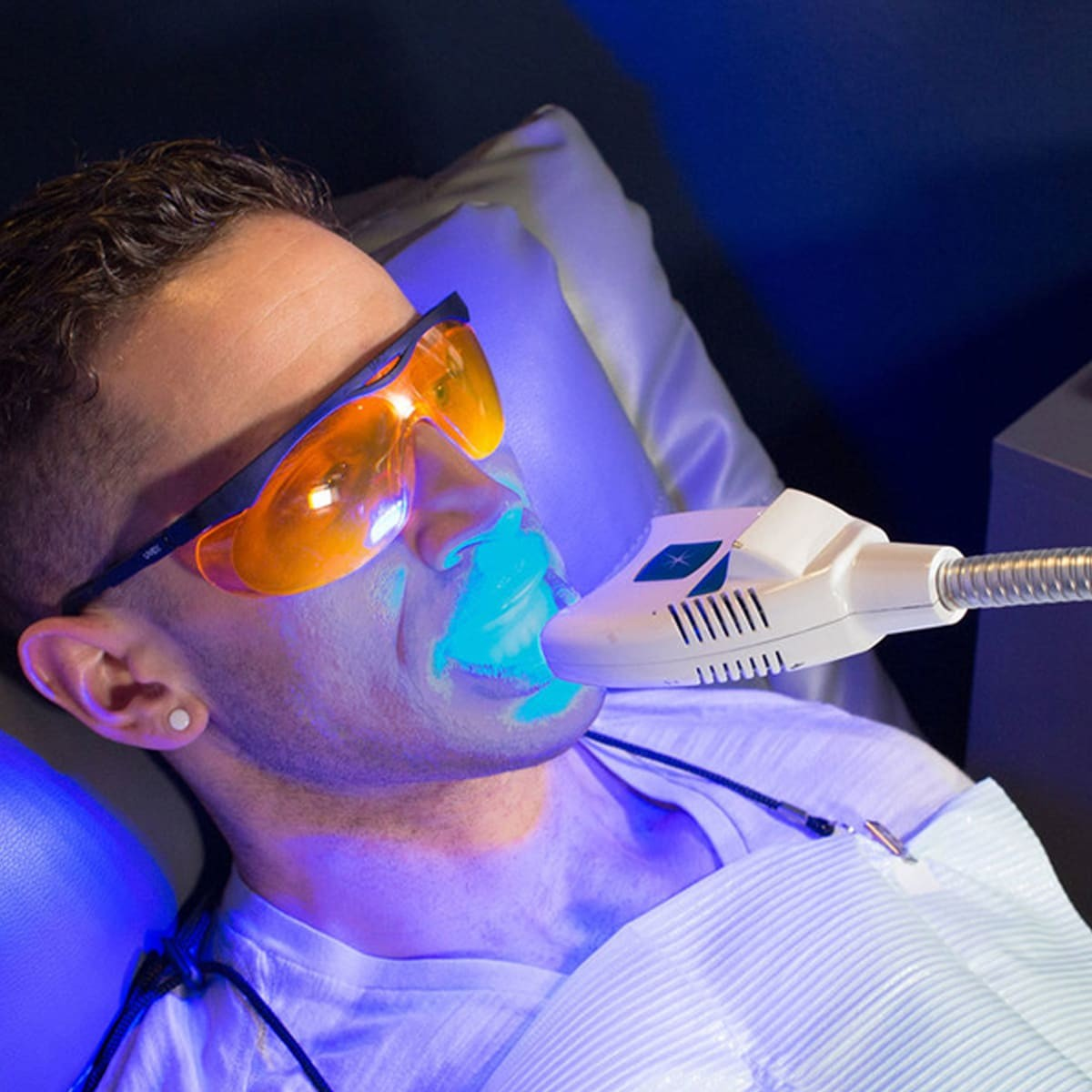 Tẩy trắng răng bằng đèn LED