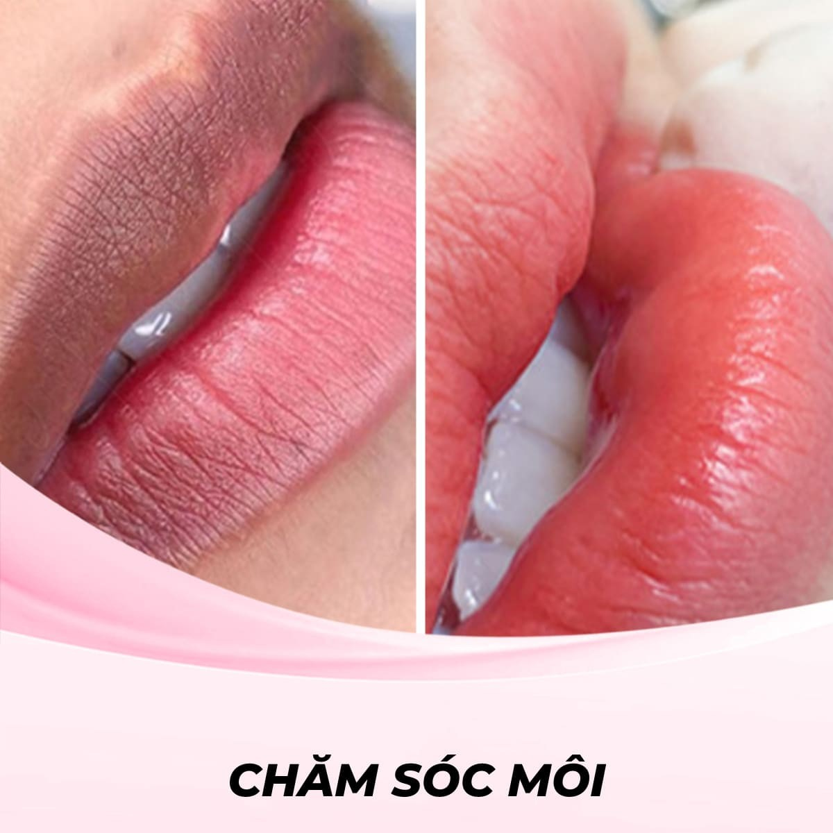 Phun Xăm Môi Ombre