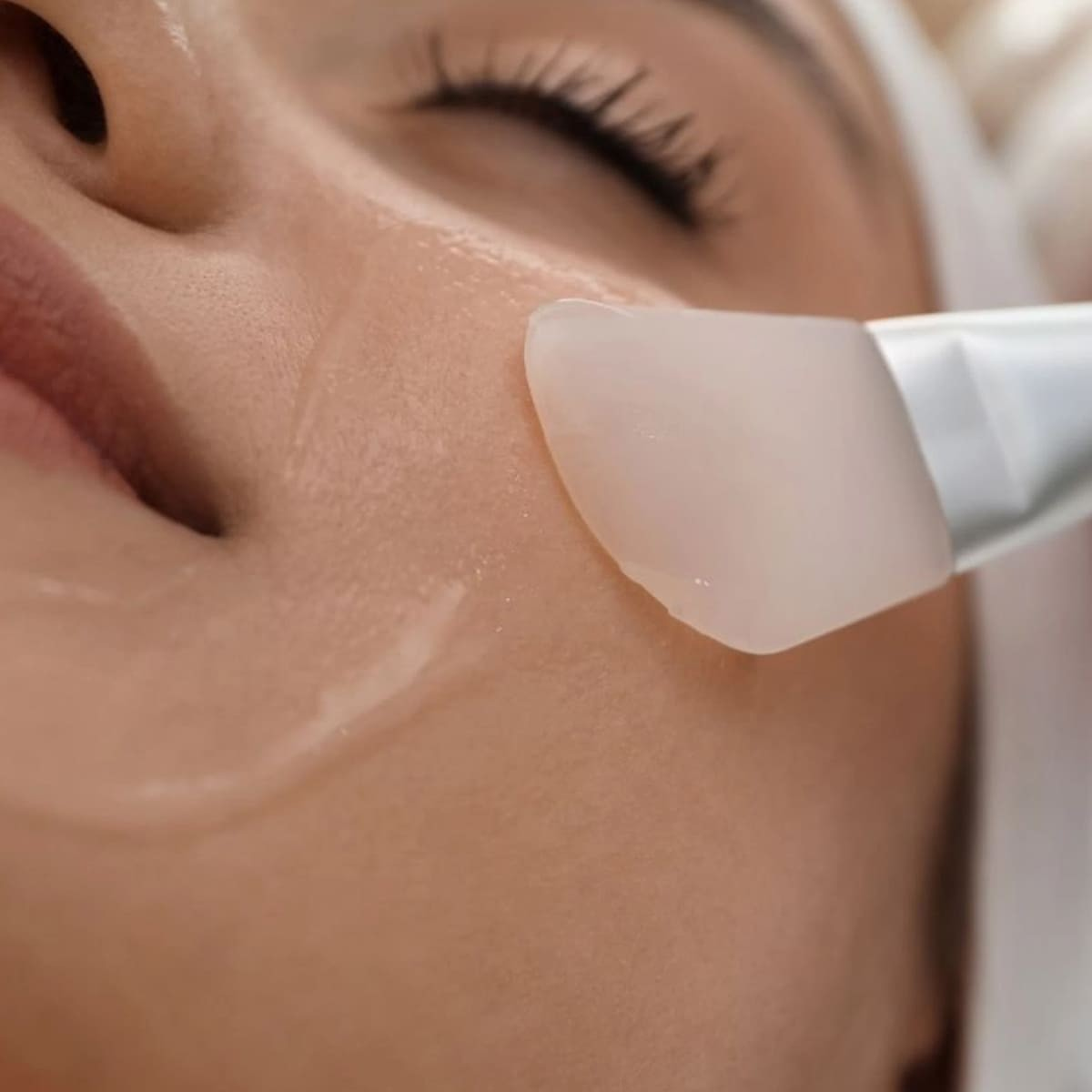 Làm hồng môi bằng Peeling hóa học